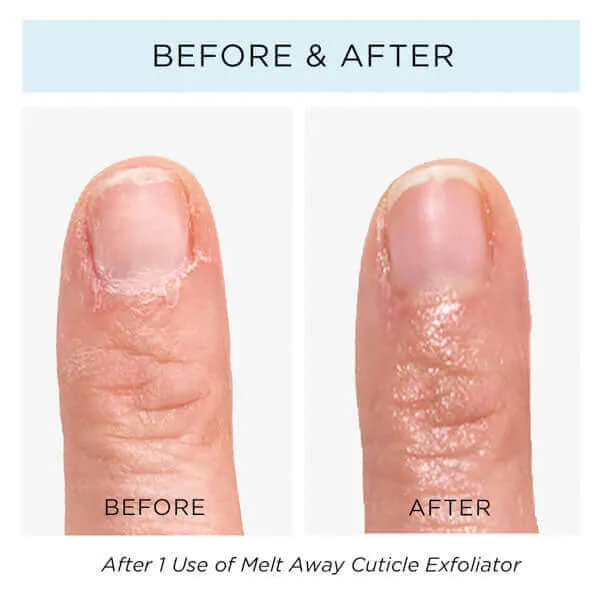 Melt Away and Push to Perfection Kit!